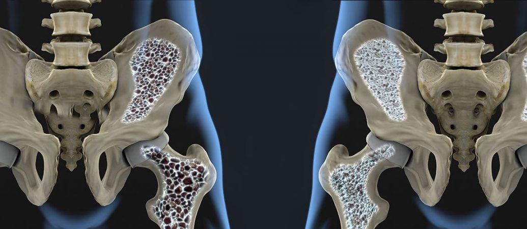 biology behind osteoporosis revealed in new study 4